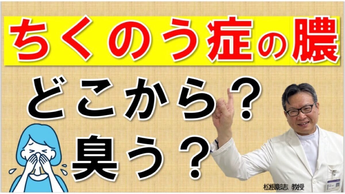 ちくのう症の膿はどこから？ニオイは周囲にも伝わる？松根彰志先生がやさしく解説 | NPO花粉症・鼻副鼻腔炎治療推進会