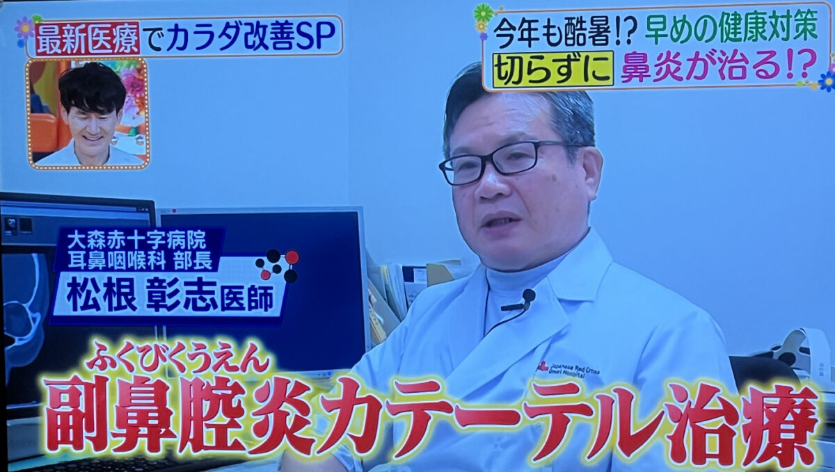 【ヒルナンデス】「早めの健康対策！切らずに鼻炎が治る⁉」～副鼻腔炎のカテーテル治療～に松根彰志副理事長が出演（2025年6月25日)