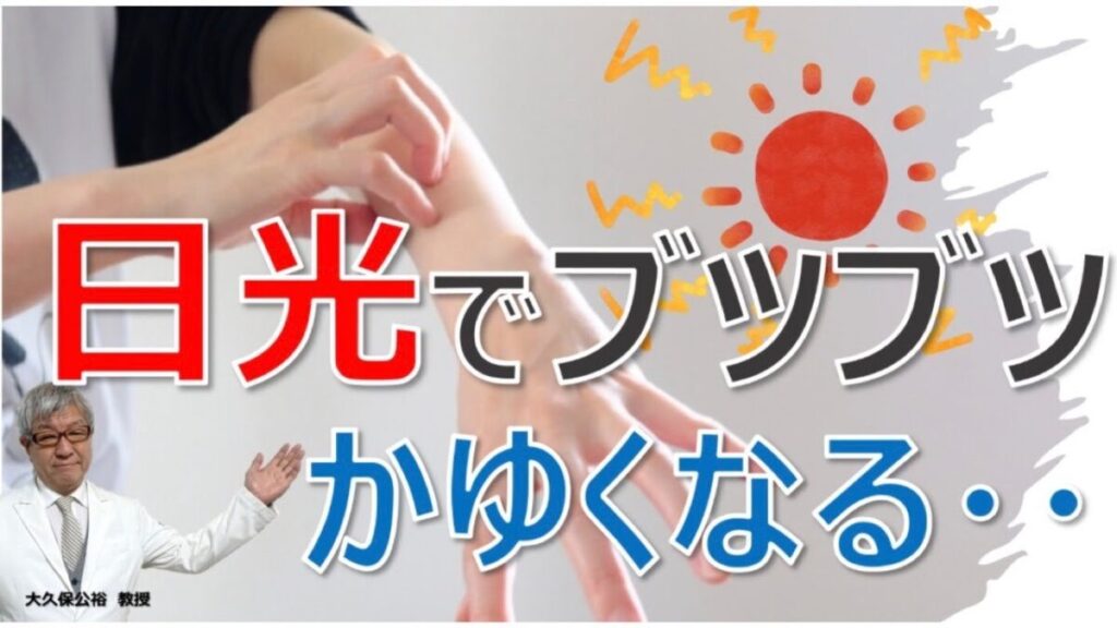 日光で肌がブツブツ・かゆくなる原因と対処法とは？大久保公裕先生が解説