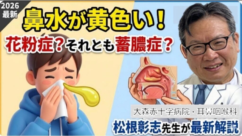【2026最新】鼻水が黄色いのは蓄膿症？花粉症併発のサインと治し方を松根彰志先生が解説
