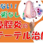 【最新】副鼻腔炎の手術をしない「カテーテル治療」とは？効果や費用を松根彰志先生が解説