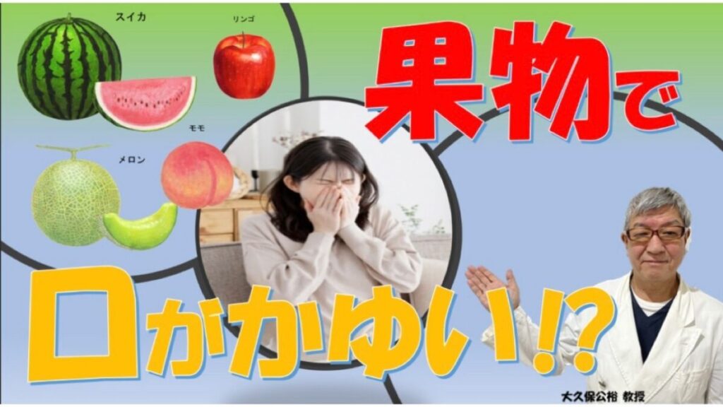 夏の果物（スイカ、メロン、モモ）で口がかゆい！花粉症と関係する？大久保公裕先生が解説